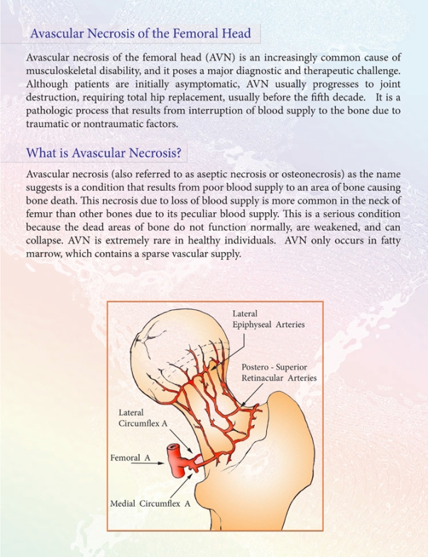 AVN of Hip Joint AVN of Hip Joint