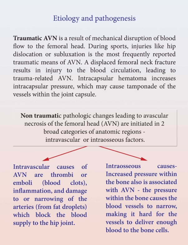 AVN of Hip Joint AVN of Hip Joint