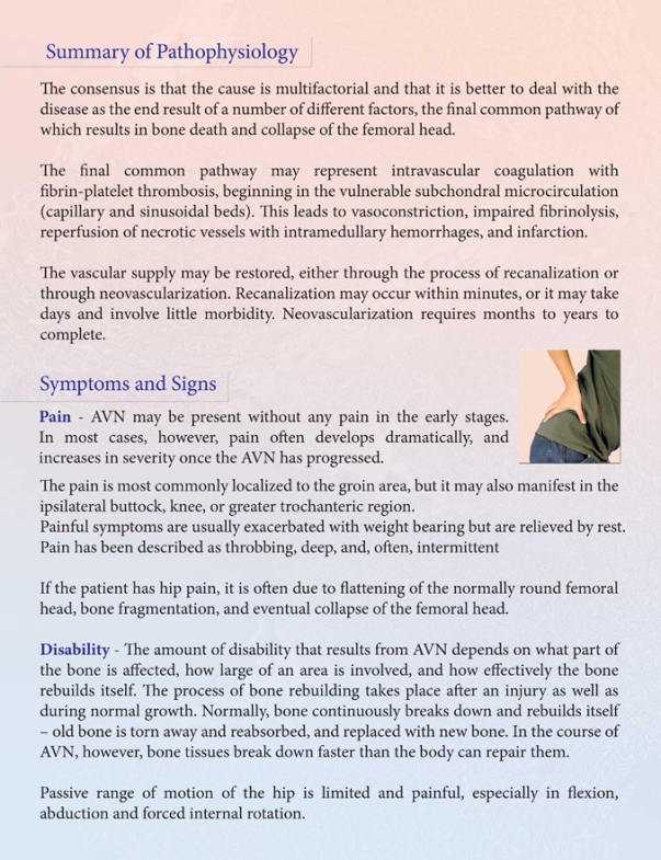 AVN of Hip Joint AVN of Hip Joint
