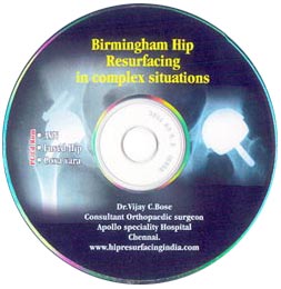 Birmingham Hip Resurfacing in Complex Situations - Free CD - Teaching & Demo