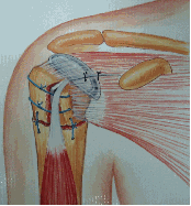 Shoulder Fractures