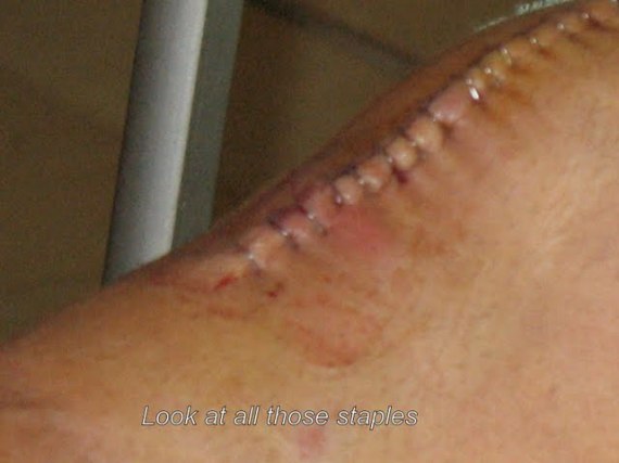 Look at all those staples