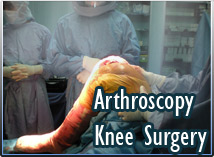 Arthroscopic Knee Surgery