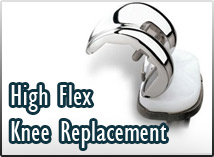 High Flex Knee Replacement