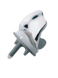 Fixed bearing Prosthesis