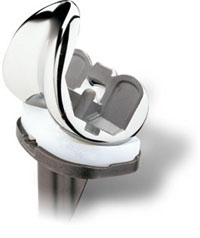 High Flex knee prosthesis High Flex knee prosthesis