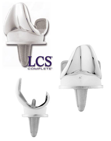  Mobile-Bearing Prosthesis