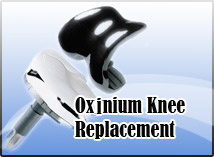 Oxinium Knee Replacement