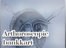 Arthroscopic Shoulder Surgery