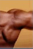 Shoulder of Calcific Deposits