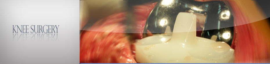 Joint Reconstruction Group, Chennai. Joint Reconstruction Group, Chennai
